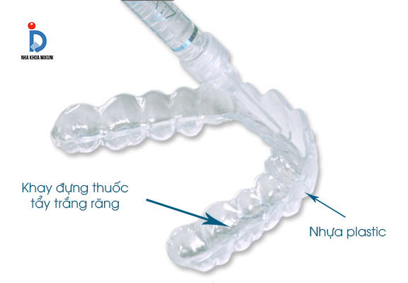 máng tẩy trắng răng